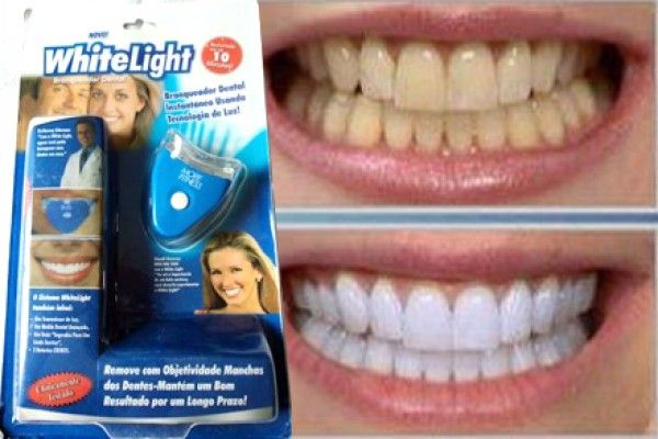 Clareador dental WhiteLight